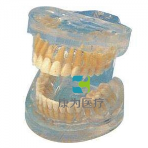 日喀则“康为医疗”透明成人牙模型