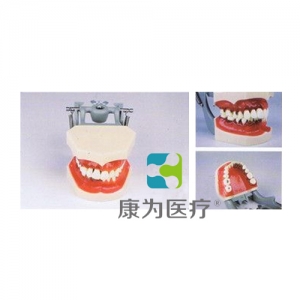 “康为医疗”牙周病模型