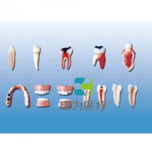“康为医疗”牙齿病变系列模型