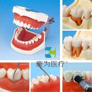 晋中“康为医疗”牙周外科实习用牙列模型