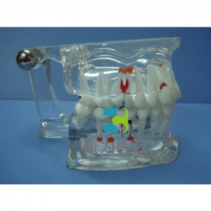 延安“康为医疗”综合病理水晶牙列模型(28颗牙)