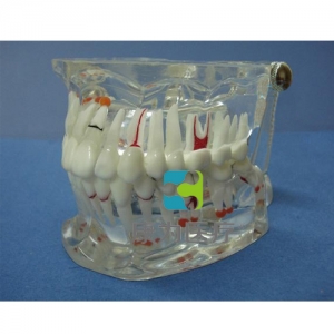 山西“康为医疗”综合病理水晶牙列模型(32颗牙)