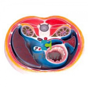 “康为医疗”腹腔横断模型