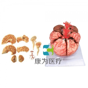 晋城“康为医疗”脑动脉模型