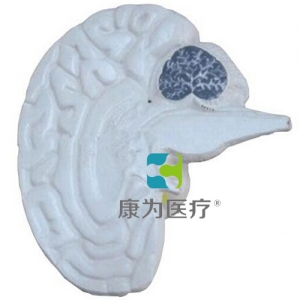 北京“康为医疗”大脑剖面模型
